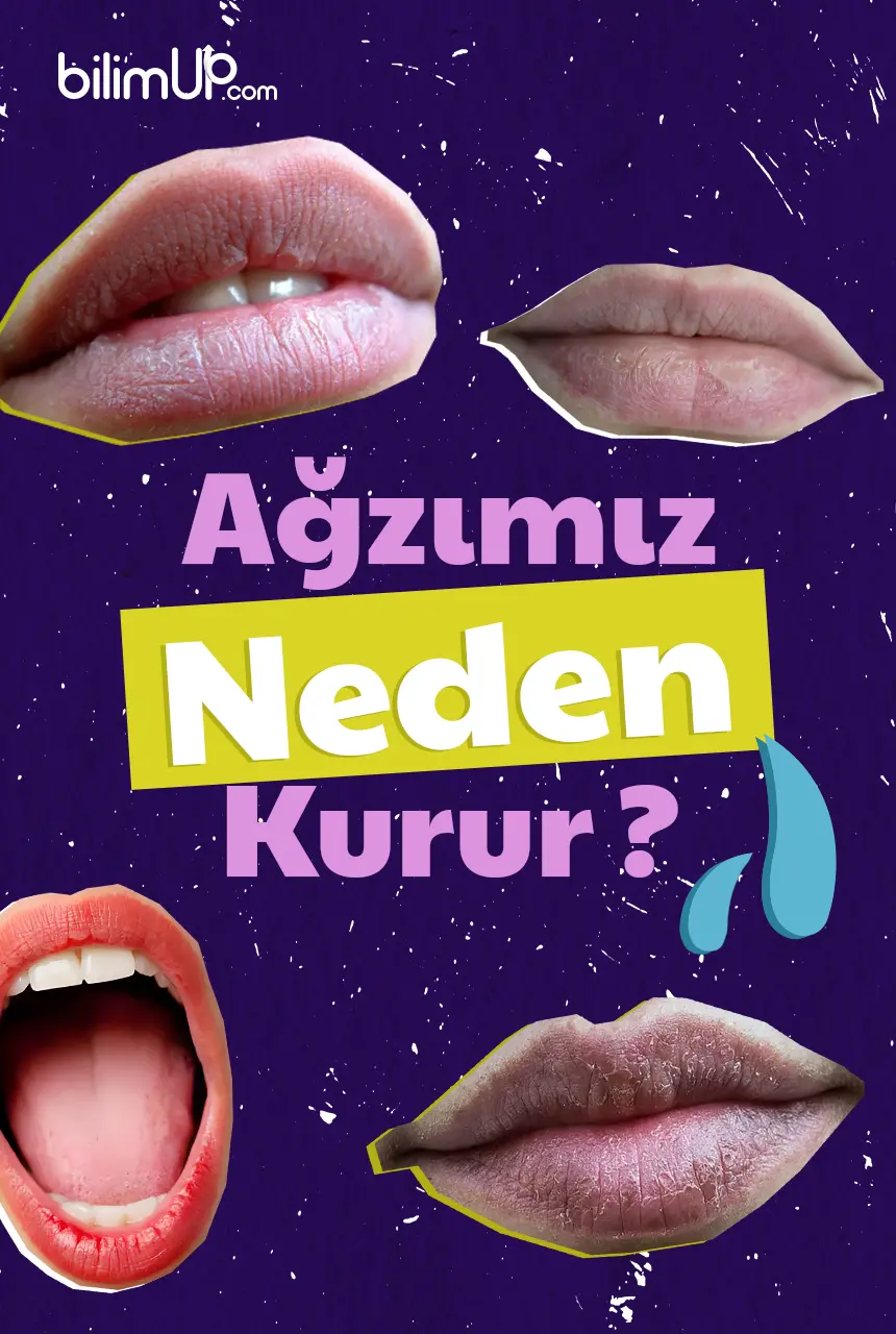 Ağzımız Neden Kurur?