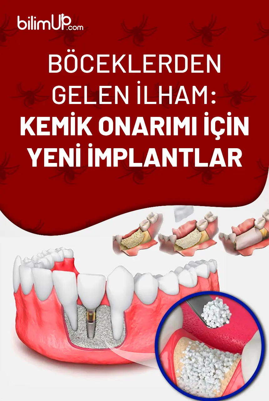 Böceklerden Gelen İlham: Kemik Onarımı için Yeni İmplantlar