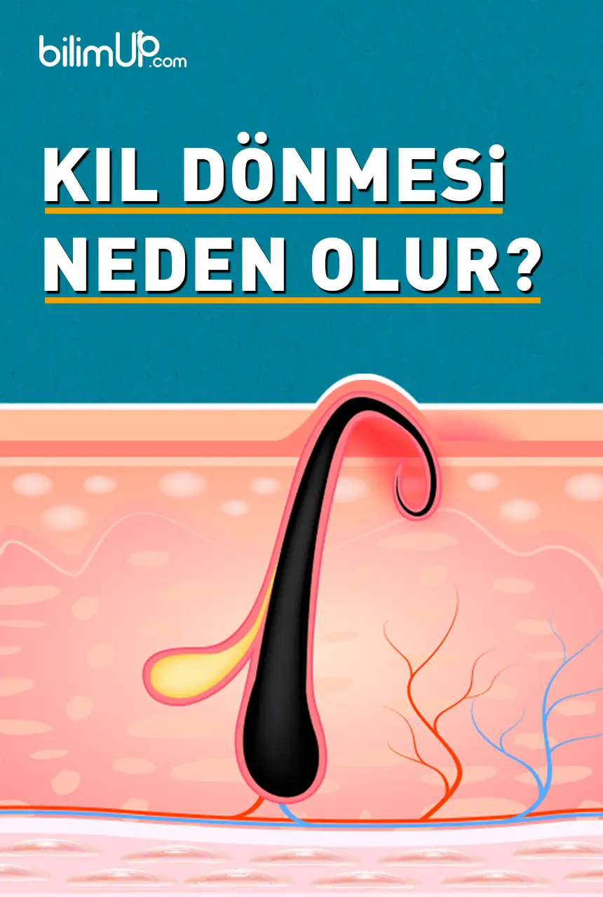 Kıl Dönmesi Neden Olur?