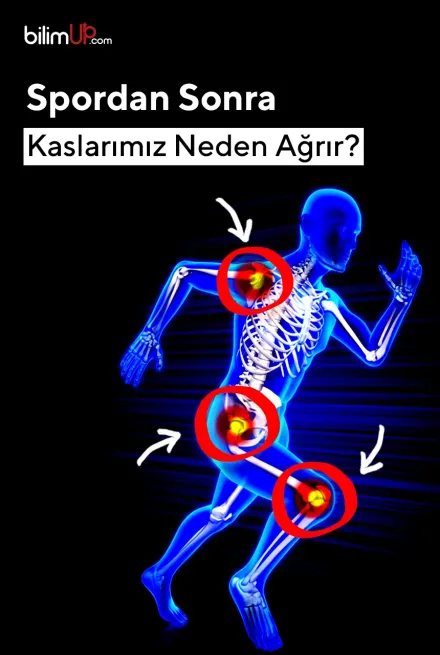 Spordan Sonra Kaslarımız Neden Ağrır?