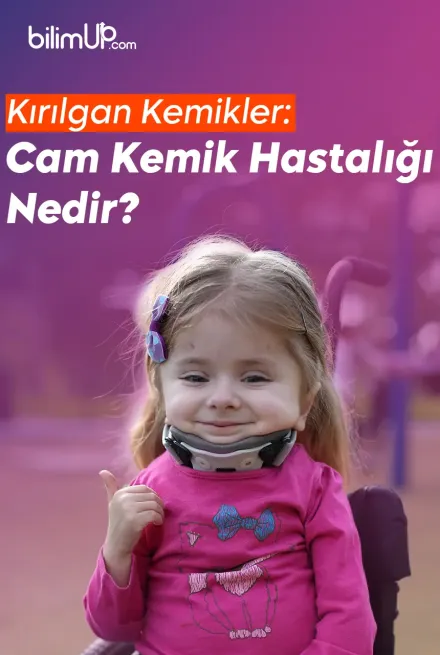 Kırılgan Kemikler: Cam Kemik Hastalığı