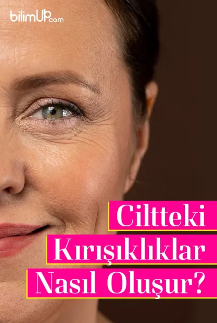 Ciltteki Kırışıklıklar Nasıl Oluşur?