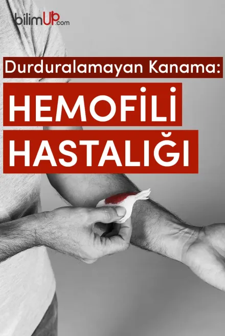 Durduralamayan Kanama: Hemofili Hastalığı Nedir?
