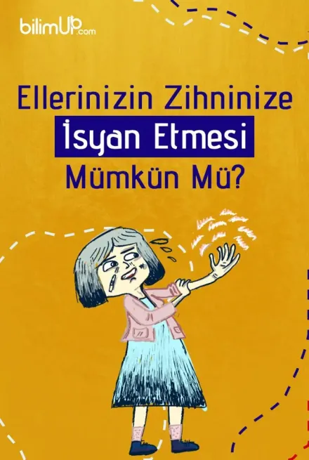 Ellerinizin Zihninize İsyan Etmesi Mümkün Mü? Yabancı El Sendromu