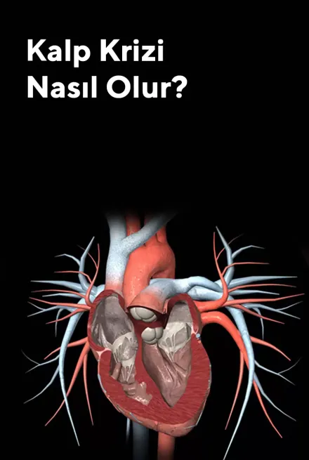 Kalp Krizi Nasıl Oluyor?