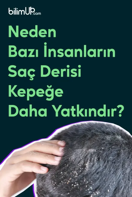 Neden Bazı İnsanların Saç Derisi Kepeğe Daha Yatkındır?