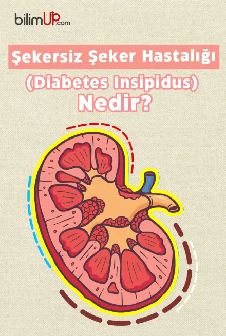 Şekersiz Şeker Hastalığı (Diabetes Insipidus) Nedir?