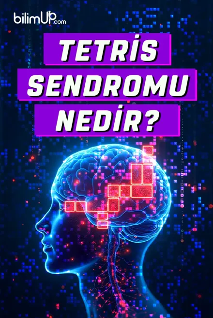 Tetris Sendromu Nedir?