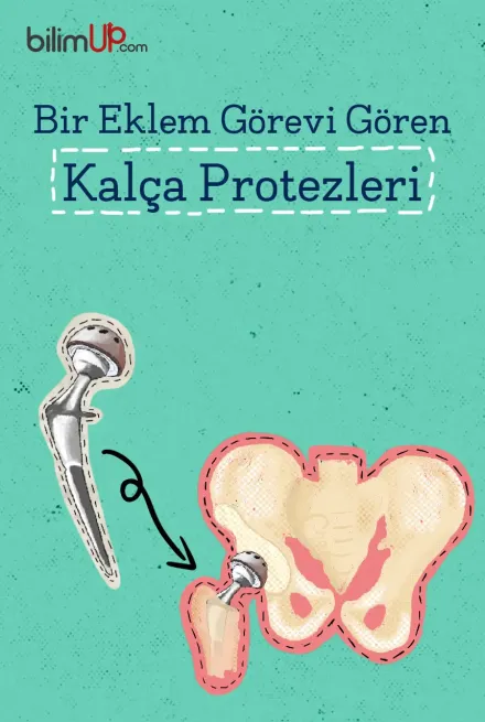 Bir Eklem Görevi Gören Kalça Protezleri
