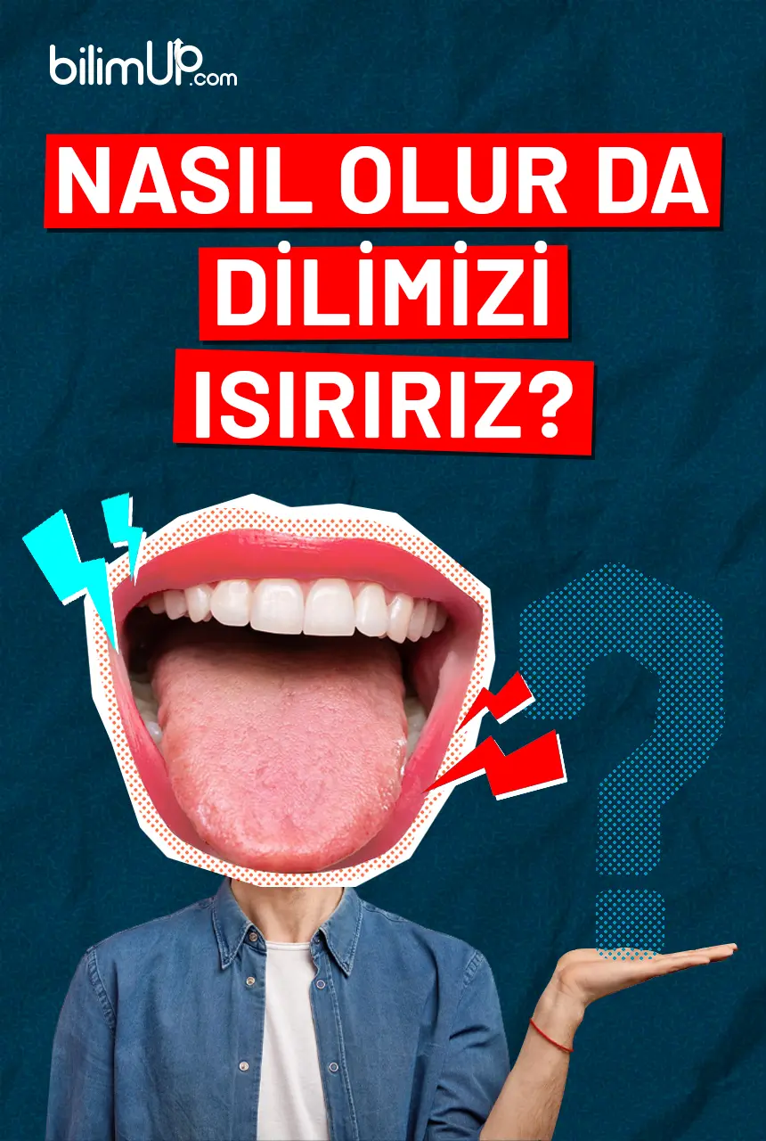 Nasıl Olur da Dilimizi Isırırız?