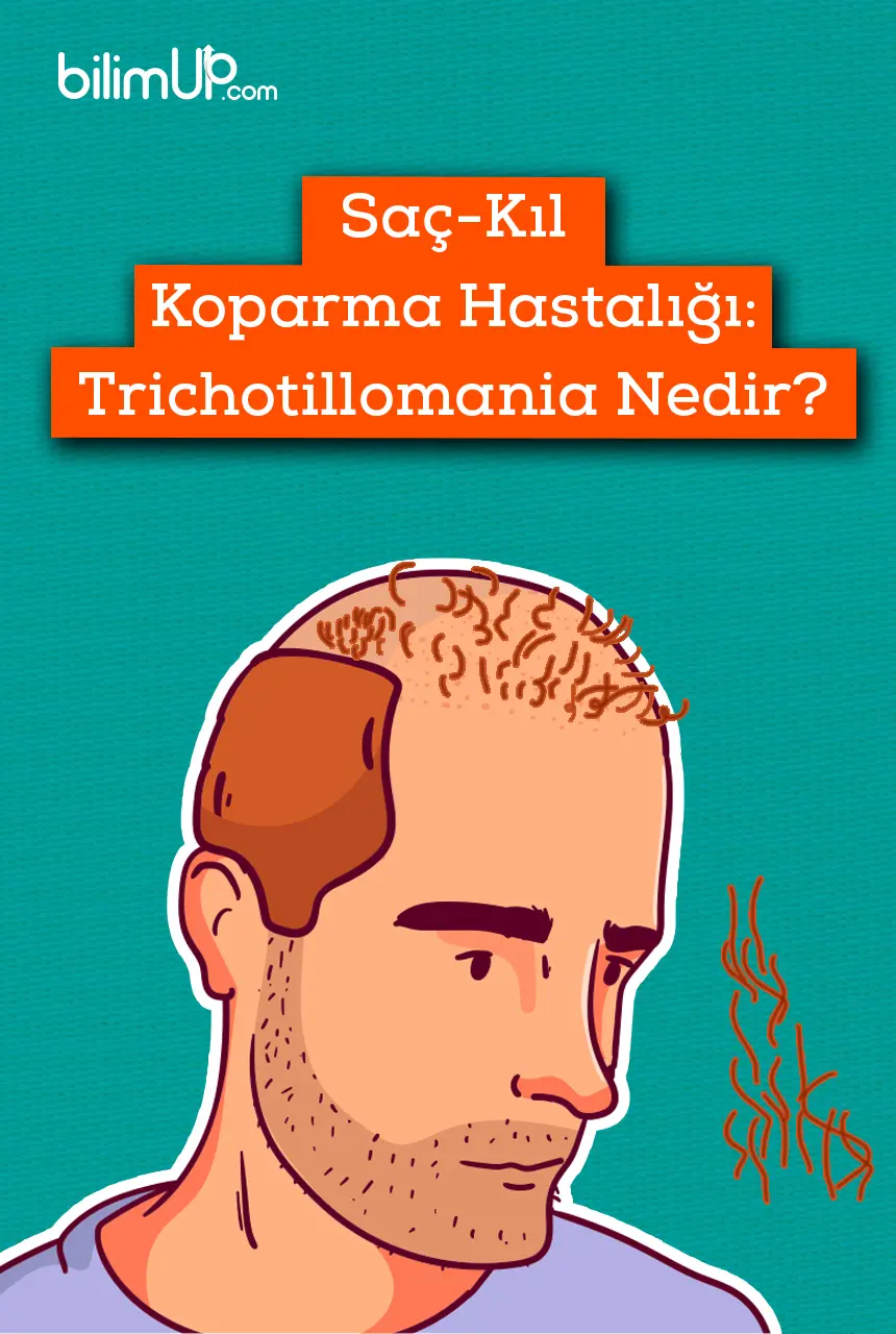 Saç-Kıl Koparma Hastalığı: Trichotillomania Nedir?