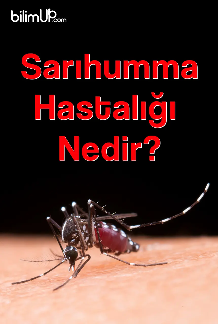 Sarıhumma Hastalığı Nedir?
