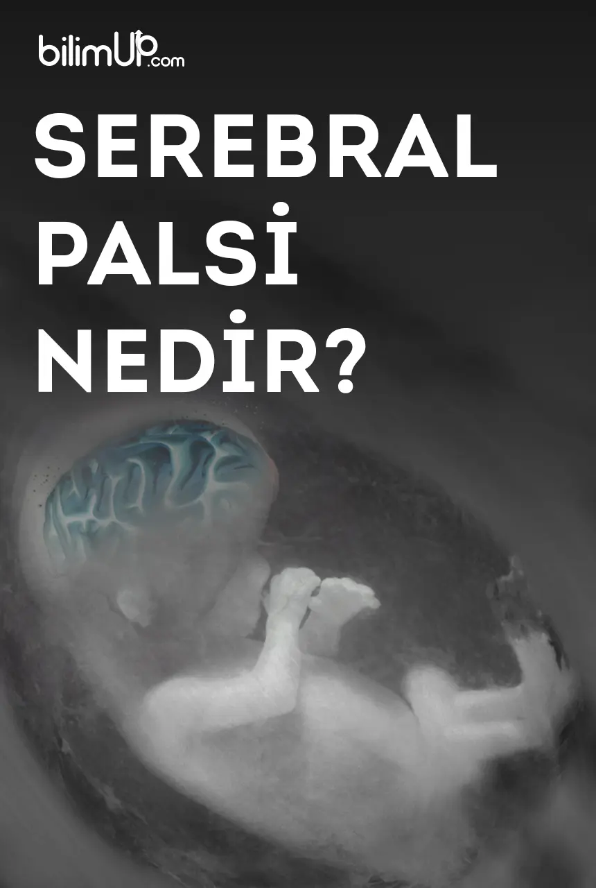serebral paralizi nedir
