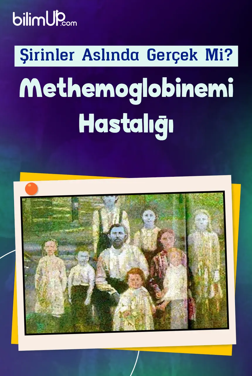Şirinler Aslında Gerçek Mi? Methemoglobinemi Hastalığı