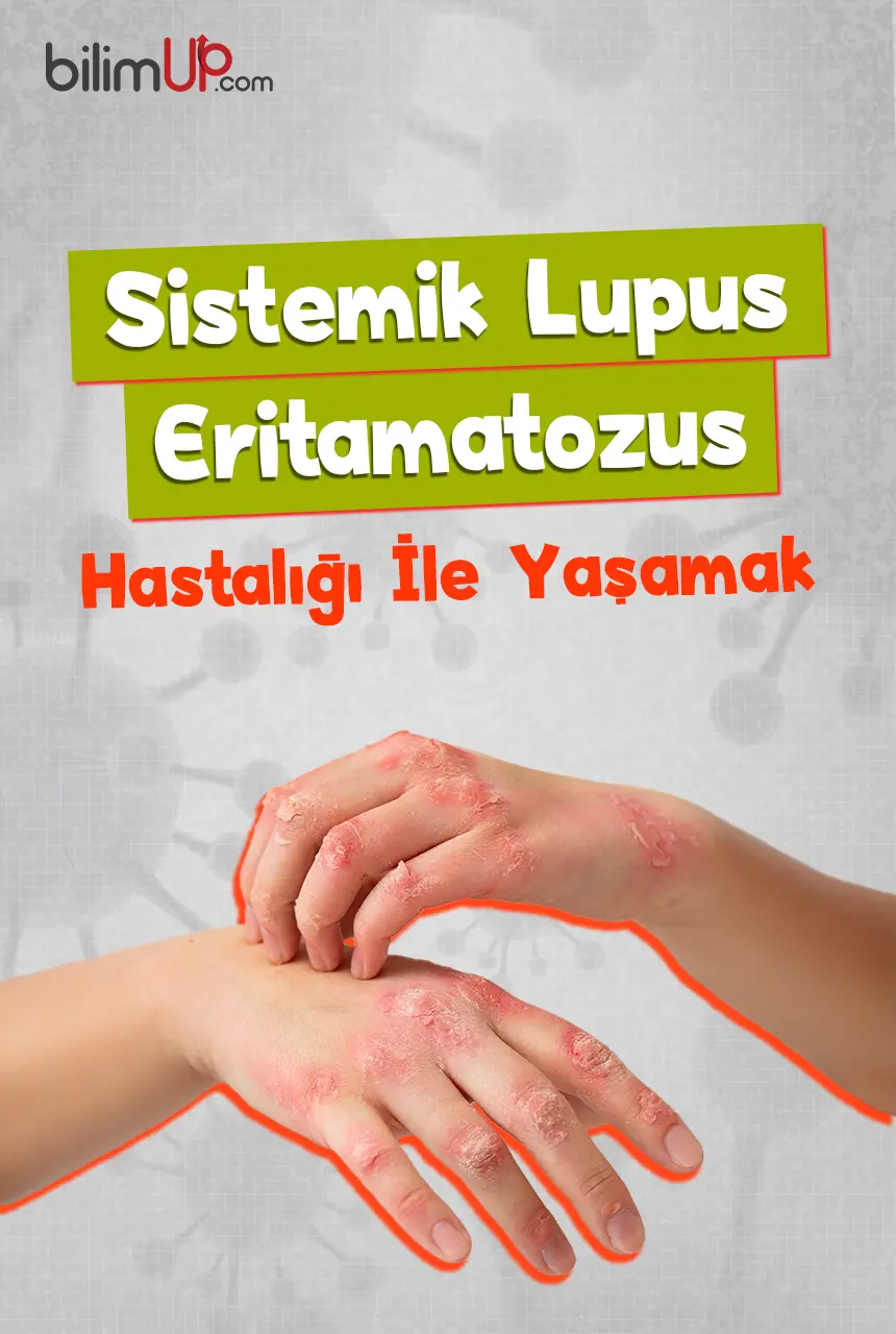 Sistemik Lupus Eritamatozus Hastalığı İle Yaşamak