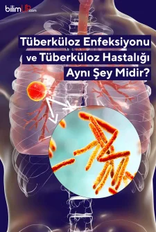 Tüberküloz Enfeksiyonu ve Tüberküloz Hastalığı Aynı Şey Midir?