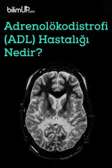 Adrenolökodistrofi (ADL) Hastalığı Nedir?