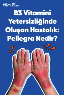 B3 Vitamini Yetersizliğinde Oluşan Hastalık: Pellegra Nedir?