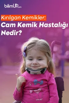 Kırılgan Kemikler: Cam Kemik Hastalığı