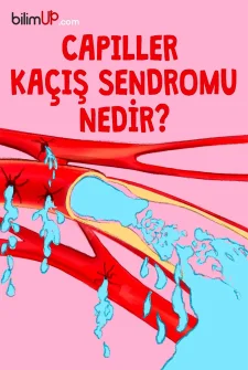 Kapiller Kaçış Sendromu Nedir?