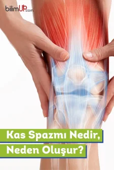 Kas Spazmı Nedir, Neden Oluşur?