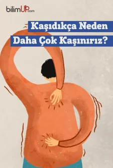 Kaşıdıkça Neden Daha Çok Kaşınırız?