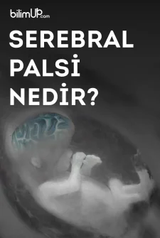 Serebral Palsi Nedir?