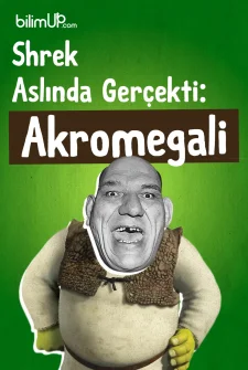 Shrek Aslında Gerçekti: Akromegali