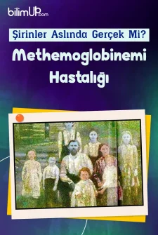 Şirinler Aslında Gerçek Mi? Methemoglobinemi Hastalığı