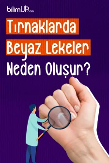 Tırnaklarda Beyaz Lekeler Neden Oluşur?