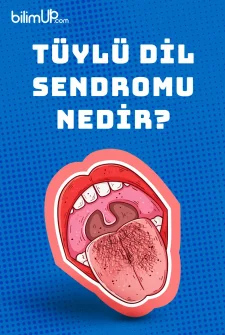 Tüylü Dil Sendromu Nedir?