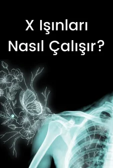 X Işını Nedir, Nasıl Çalışıyor?