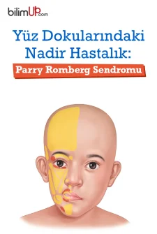 Yüz Dokularındaki Nadir Hastalık: Parry Romberg Sendromu