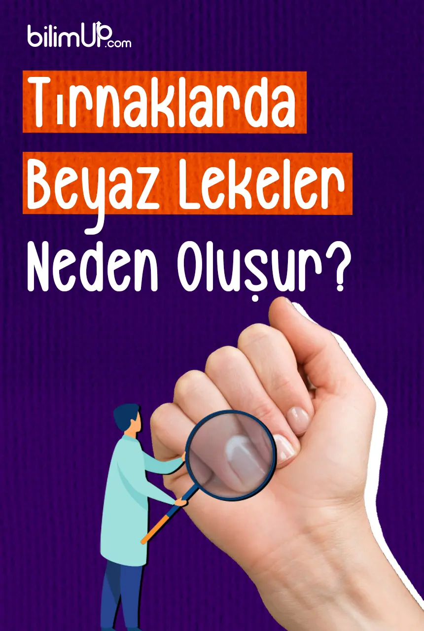 Tırnaklarda Beyaz Lekeler Neden Oluşur?