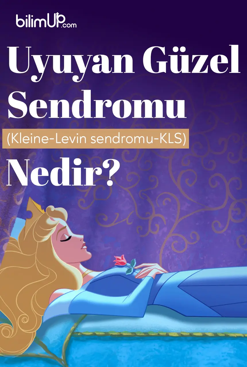 Uyuyan Güzel Sendromu (Kleine-Levin sendromu-KLS) Nedir?