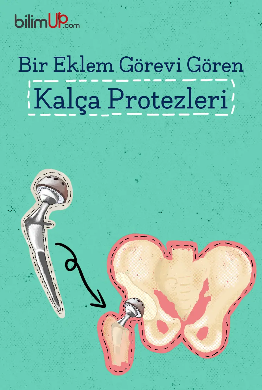 Bir Eklem Görevi Gören Kalça Protezleri